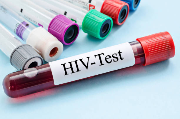  HIV enfeksiyonunda uzmanlar, Türkiye’deki rakamların endişe vermeye başladığını belirtti